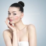 7 Things To Know Before Having Laser Treatment For Your Scar